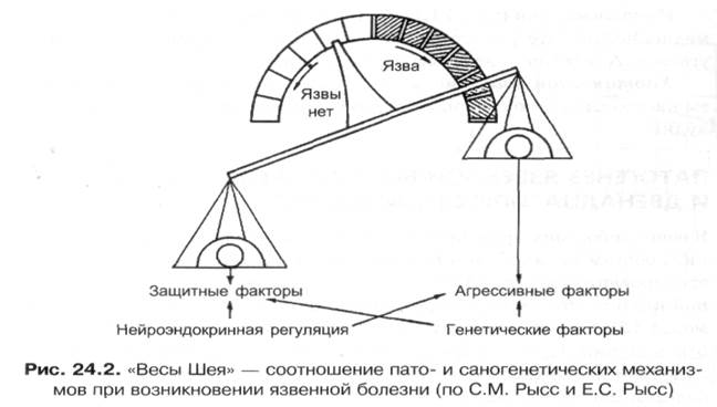 Язвенная болезнь патогенез схема